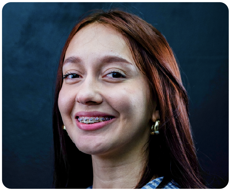 Ortodoncia preventiva